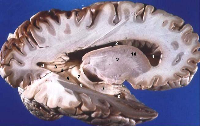 _images/cortex-RightGreyWhite.png