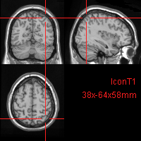 _images/cortex-StereotaxisCoor.png