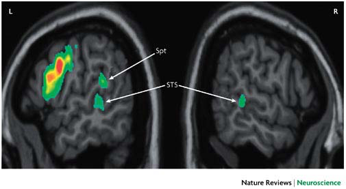 _images/dorsal-InitialfMRI.png