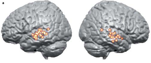 _images/sts-fMRI-STS1.png