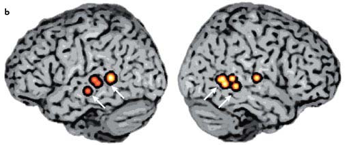 _images/sts-fMRI-STS2.png