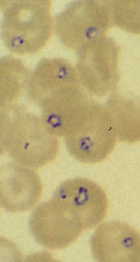 Babesia microti