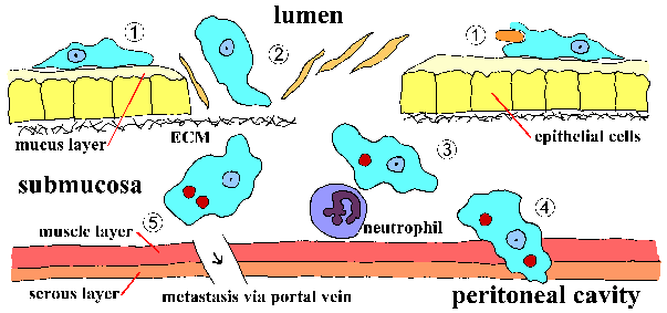 Amebiasis Pathogenesis