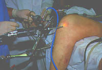Using the Probe