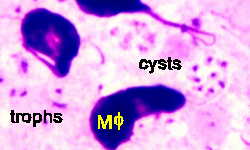 Giemsa Stain